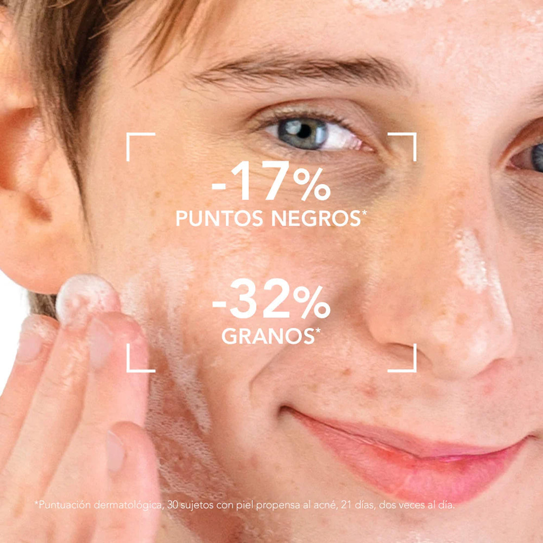 Gel limpiador purificante para piel grasa con acné inflamado 200ml – Bioderma Sébium Gel Moussant Actif