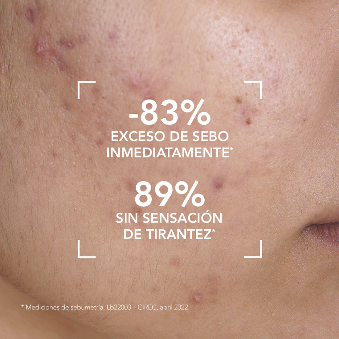 Gel limpiador purificante y antiimperfecciones para piel con tendencia acneica 200ml – Bioderma Sébium Gel Moussant