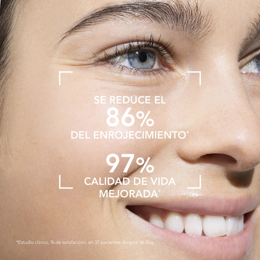 Bioderma Crema Calmante Antirojez para Piel Sensible y Reactiva 40ml - Sensibio AR Crema