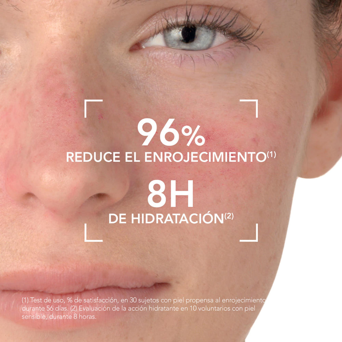Bioderma Photoderm AR SPF50+ | Protector solar con color para piel con rojeces – 30ml